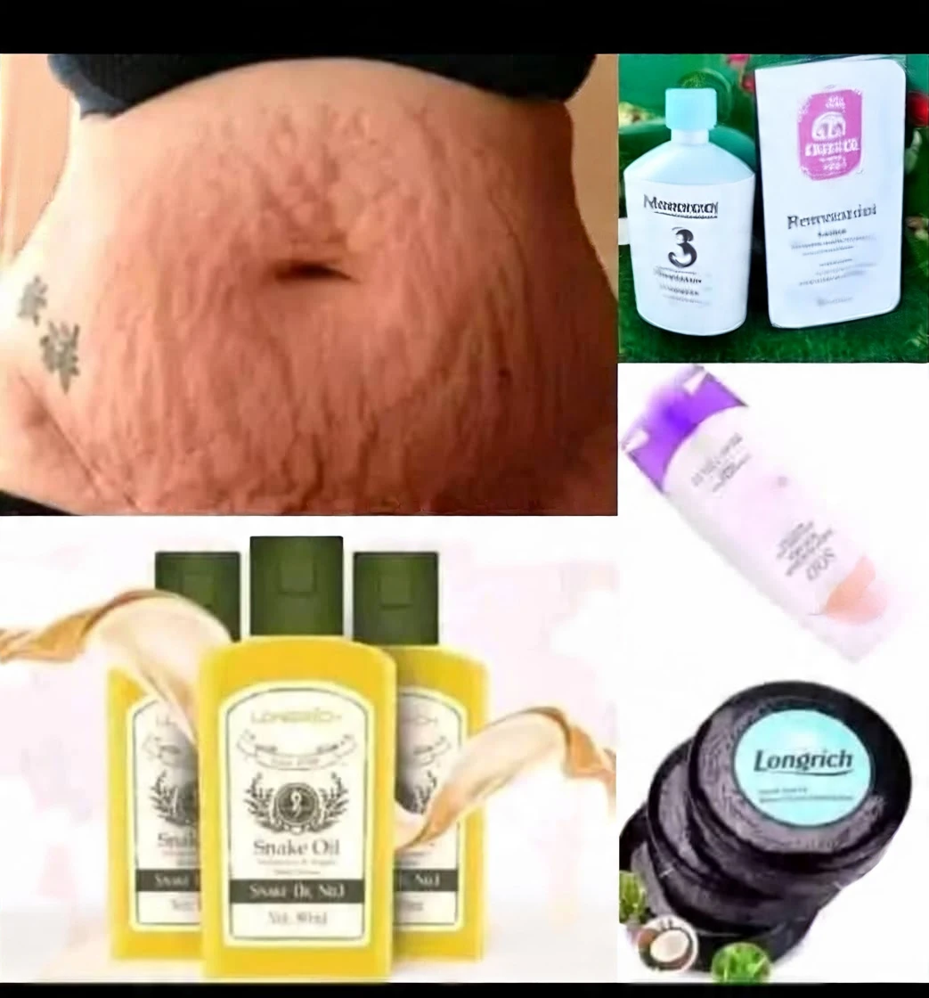 longrich stretch marks skin care combo
